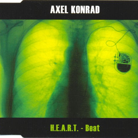 Axel Konrad - H.E.A.R.T. Beat (Radio Mix) (2000)